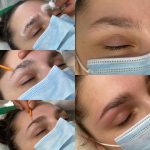 Brow lift (laminiranje obrva)