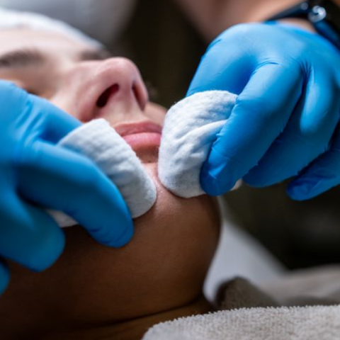Tretman za nečistu kožu — Jajetić Health & Beauty Centar