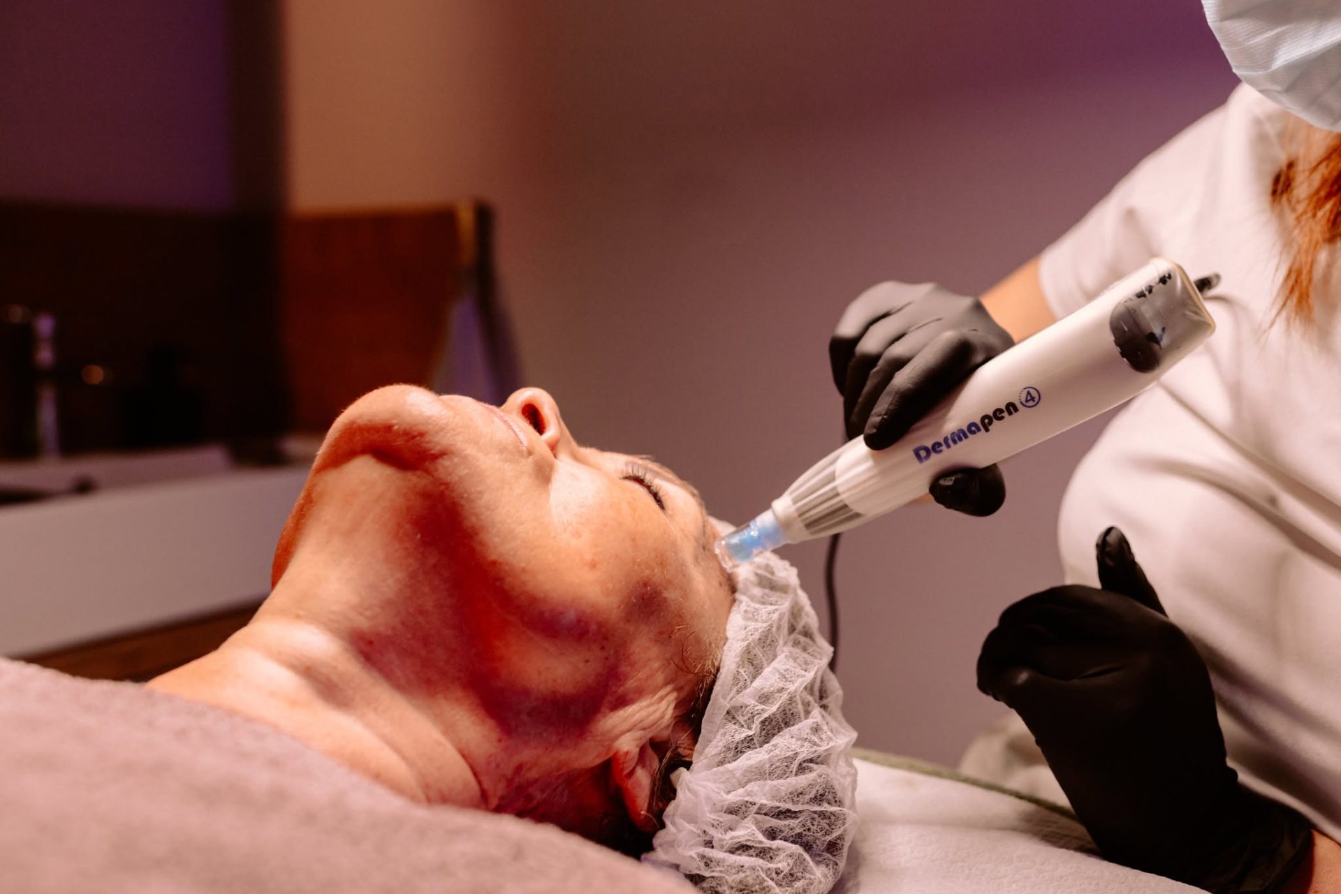 Dermapen 4